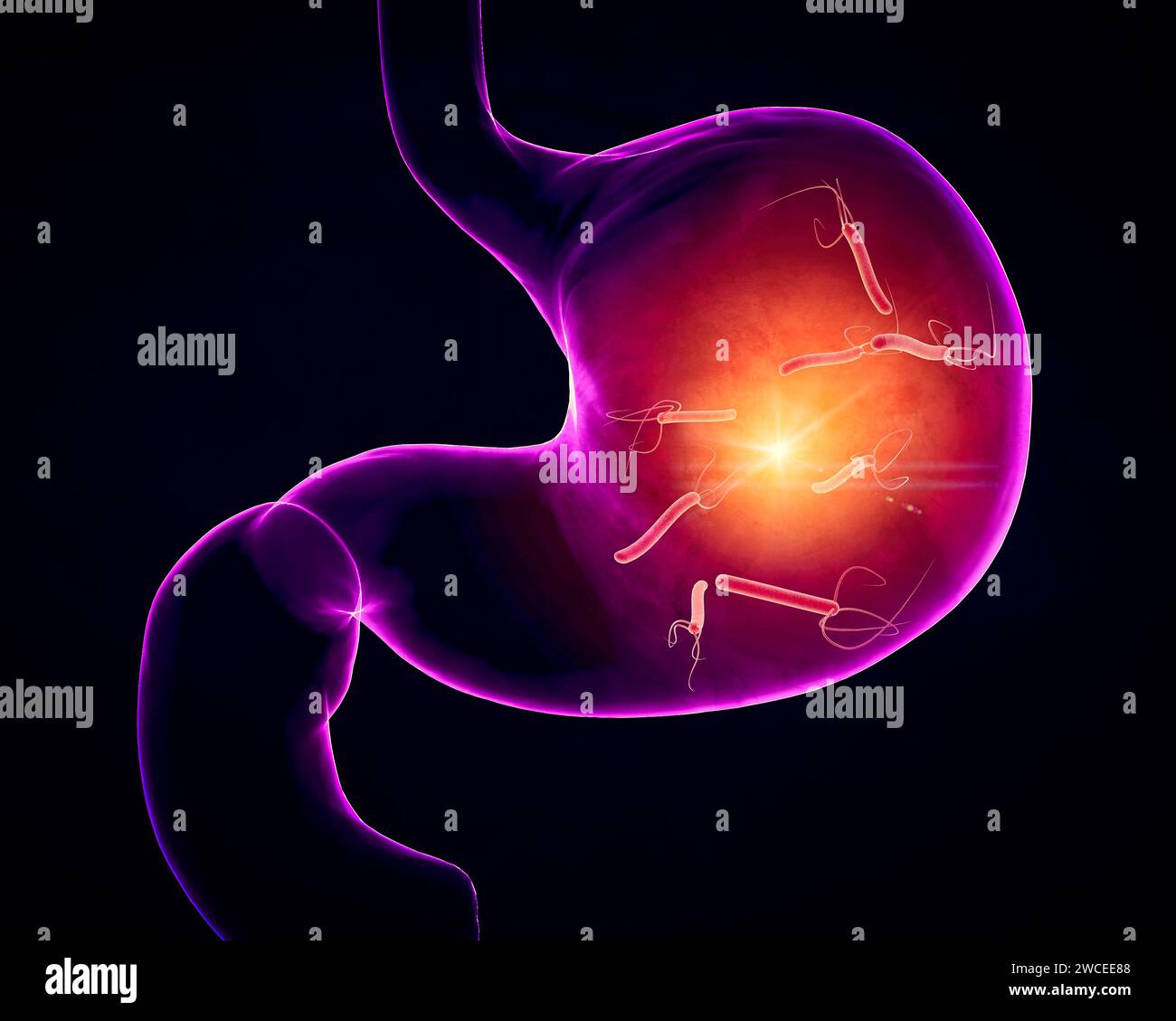 Helicobacter pylori est une bactérie à Gram négatif, flagellée, hélicoïdale. Il est capable de coloniser la muqueuse gastrique. rendu 3d. Banque D'Images