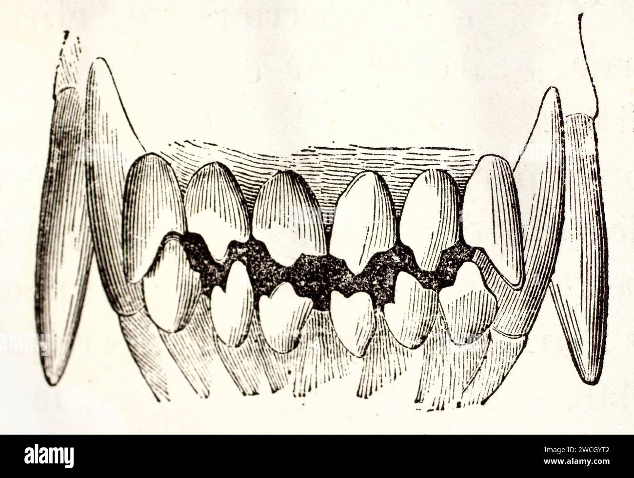 Vue rapprochée de l'incisive du chien et des dents canines, la gravure anatomique isole la dentition sur fond blanc. 1878 dessin au trait expressif de sports de gravure sur bois. Banque D'Images