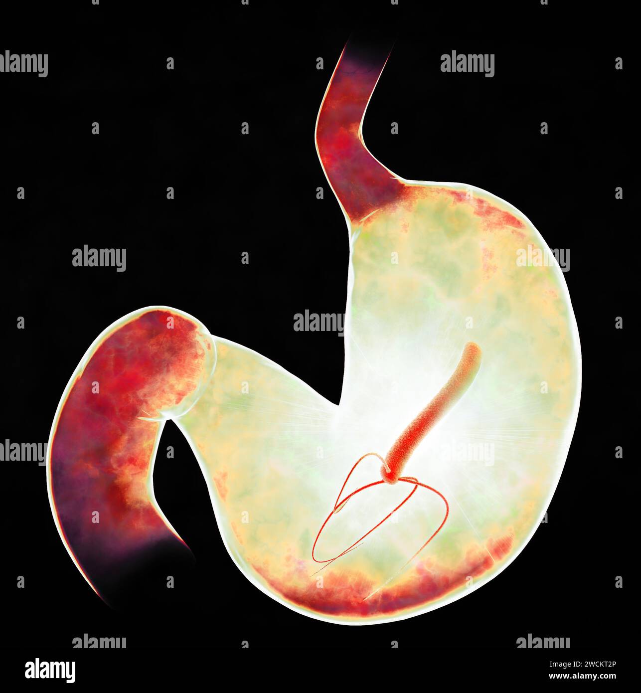 Helicobacter pylori est une bactérie à Gram négatif, flagellée, hélicoïdale. Il est capable de coloniser la muqueuse gastrique. rendu 3d. Banque D'Images