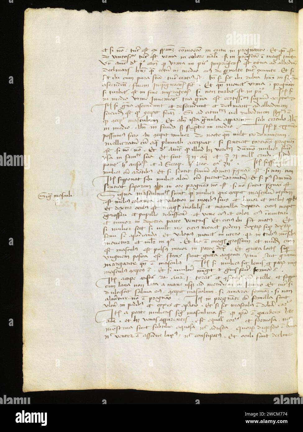 Aarau, Aargauer Kantonsbibliothek, MsMurF 85, F. 2 0035v – Antonius Guainerius, Tractatus medicinales. Banque D'Images