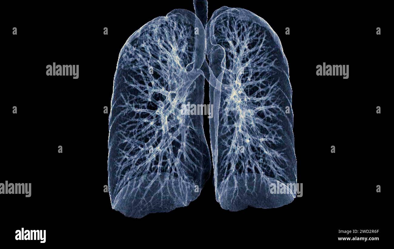 Image CT thorax or Lung 3D montrant la trachée et le poumon dans le système respiratoire. Banque D'Images