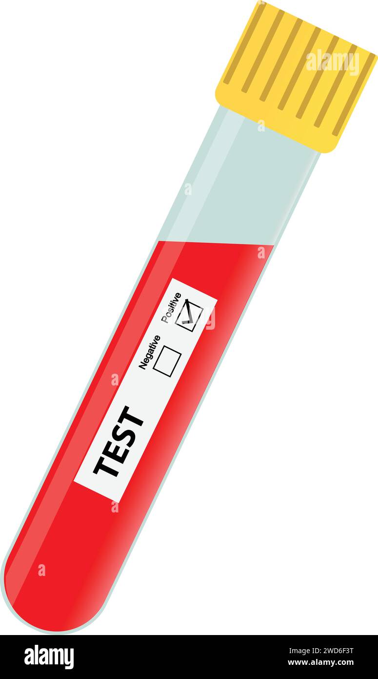 Tube d'essai de sang avec le sang, échantillon de sang d'essai médical, résultat d'essai positif Illustration de Vecteur Tube d'essai de sang avec le sang, échantillon de sang d'essai médical, résultat d'essai positif Illustration de Vecteur