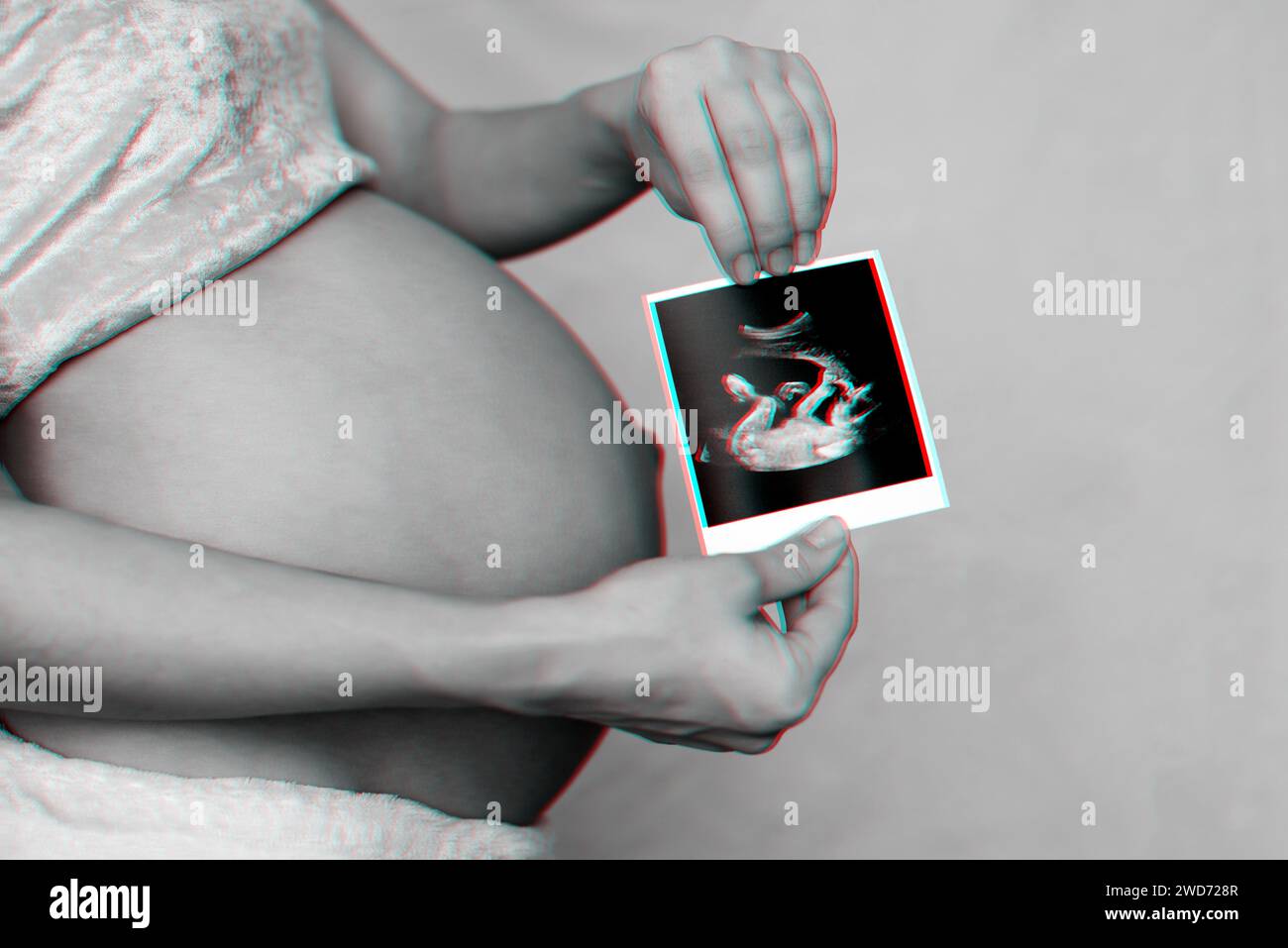 photo d'une échographie enceinte dans les mains d'une fille enceinte sur le fond de l'abdomen. Photographie monochrome avec effet pépin 3D. Banque D'Images