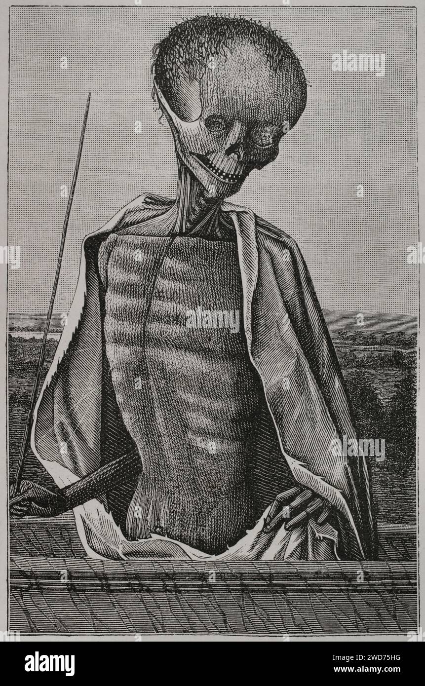 Docteur Death. Gravure d'une miniature d'un livre d'heures du 16e siècle. Sciences & lettres au Moyen Age et à l'époque de la Renaissance. Paris, 1877. Banque D'Images