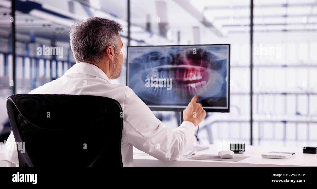 Dentiste médecin regardant les dents Xray sur l'ordinateur Banque D'Images