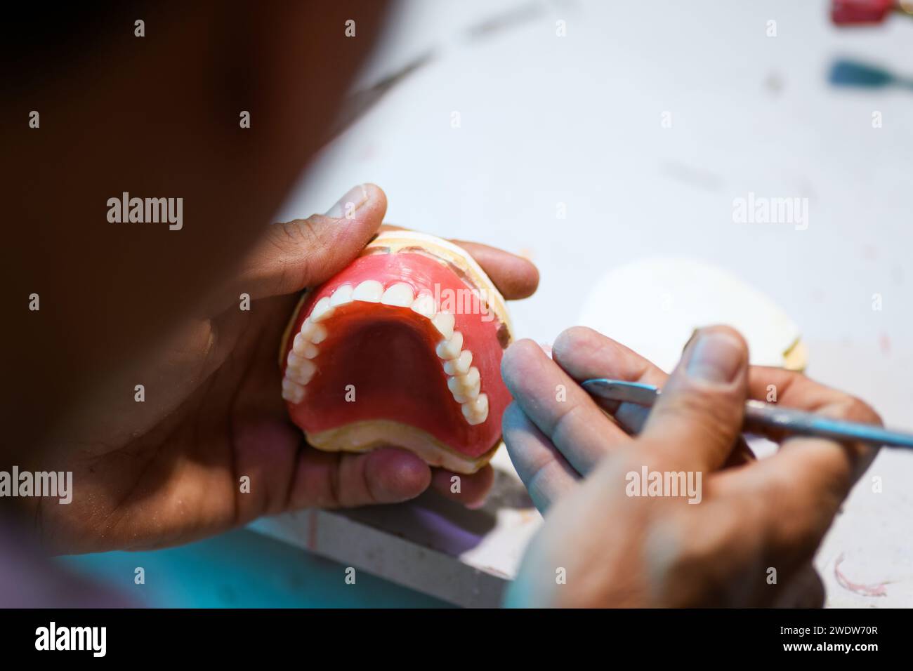 Gros plan de l'artisanat dentaire prothétique, présentant le travail détaillé de création d'une prothèse dentaire Banque D'Images