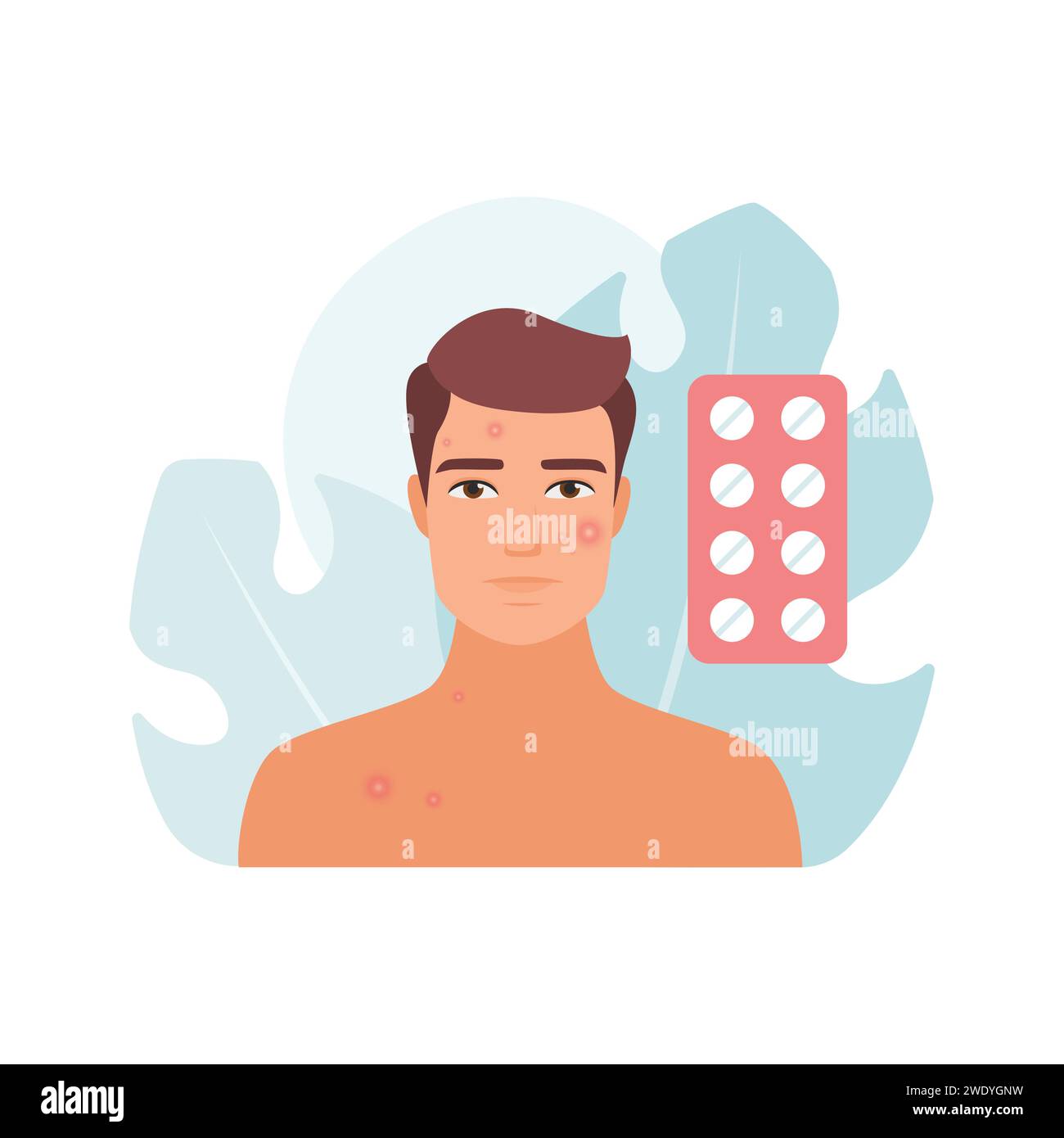 Homme inquiet triste avec boutons rouges sur le visage et pilules pour illustration de vecteur de traitement de l'acné Illustration de Vecteur
