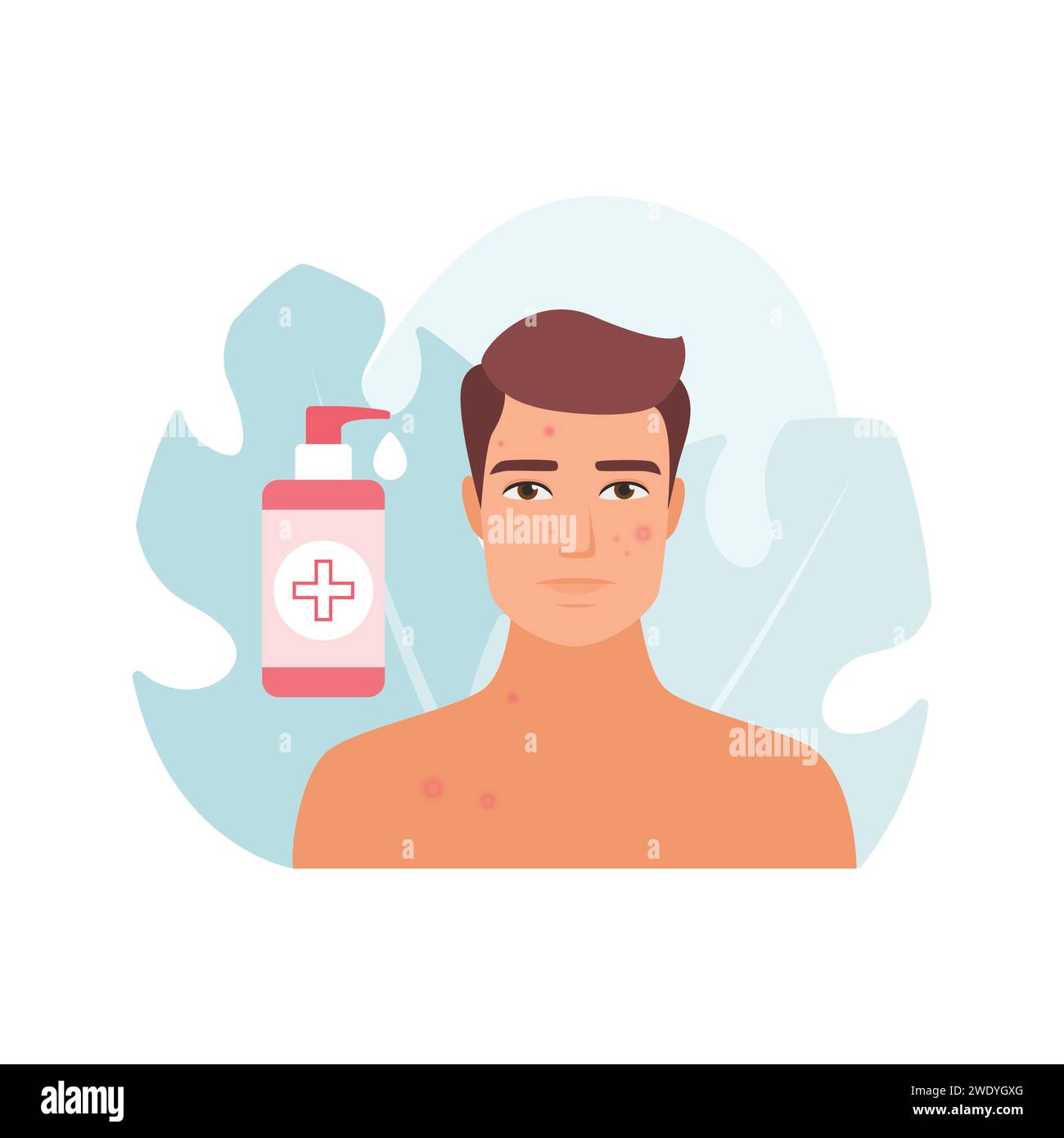 Nettoyage pour la peau de l'homme avec gel antibactérien, illustration vectorielle de traitement de l'acné pubertaire Illustration de Vecteur