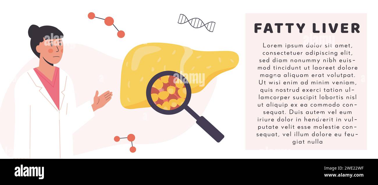 Foie gras malsain. Organe humain endommagé sous loupe avec hépatologue. Concept de chercheur médical ou de médecin étudiant le tissu adipeux de foie Illustration de Vecteur