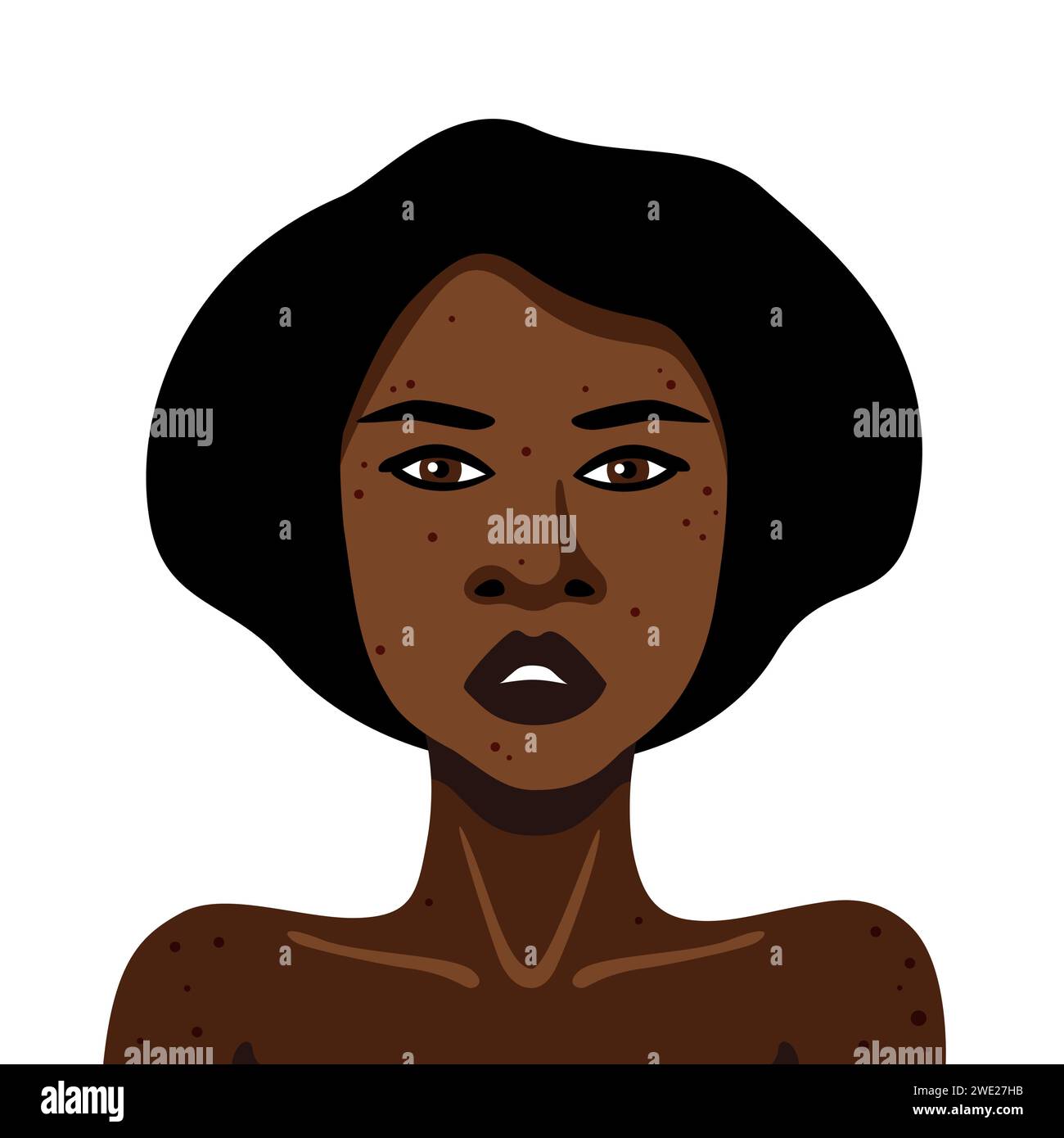 Jeune femme afro-américaine avec acné sur son corps sur une illustration vectorielle de fond blanc dans un style minimaliste Illustration de Vecteur