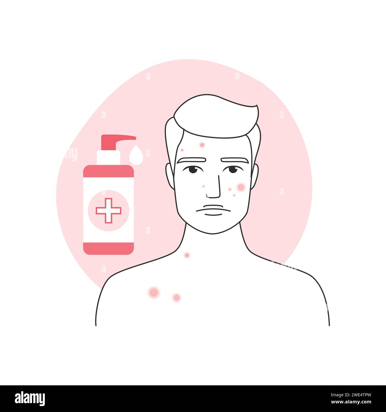 Homme triste avec acné, inflammation sur la peau du visage et gel antibactérien dans la bouteille pour l'illustration vectorielle de nettoyage Illustration de Vecteur