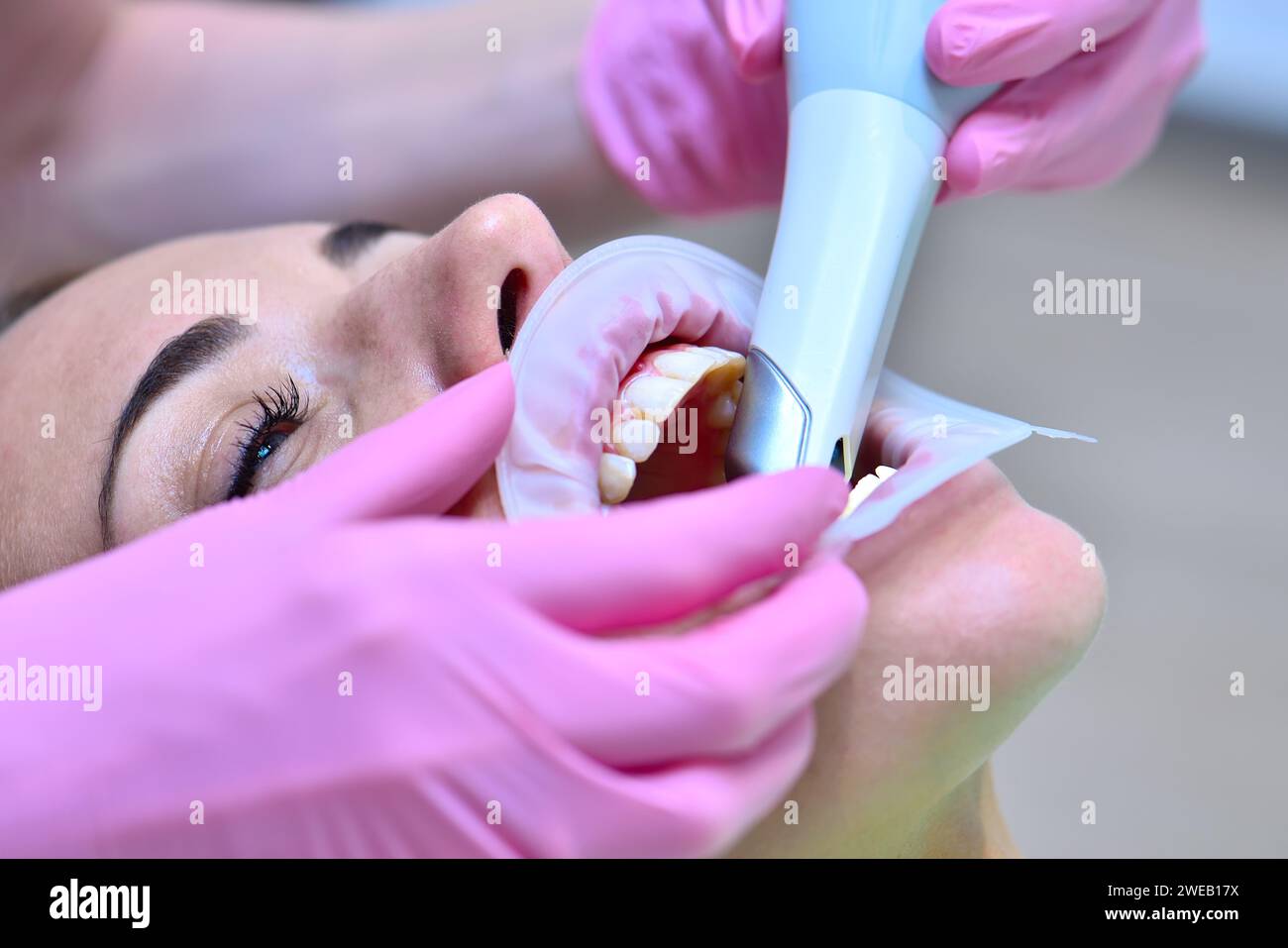 Médecin examinant les dents du patient avec un scanner 3d intra-oral. Prosthodontie et concept de stomatologie. Gros plan Banque D'Images