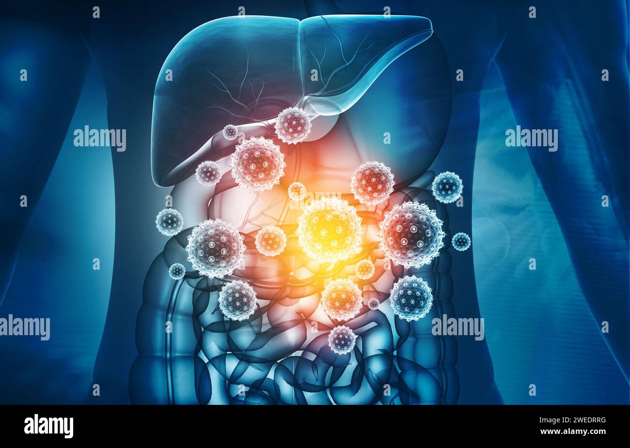 Le virus attaque le système digestif humain. illustration 3d. Banque D'Images