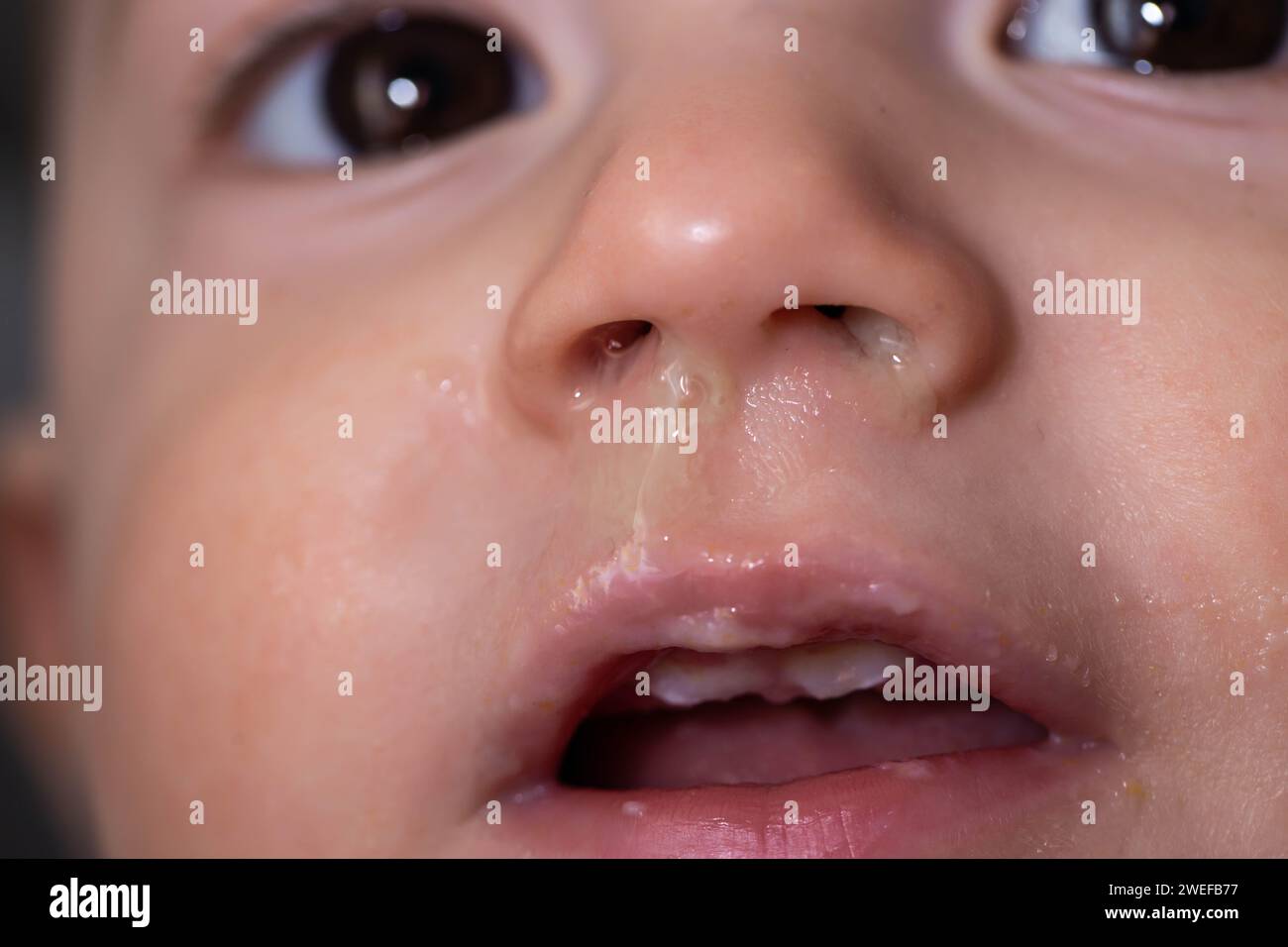 Visage d'un bébé garçon souriant avec un clin du nez. Écoulement nasal et congestion nasale chez l'enfant. Virus et infection bactérienne. Banque D'Images