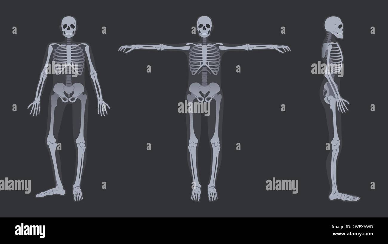 Radiographie du squelette humain. Radiologie détaillée poses anatomiques de la structure osseuse du corps entier, jeu d'illustrations vectorielles Illustration de Vecteur