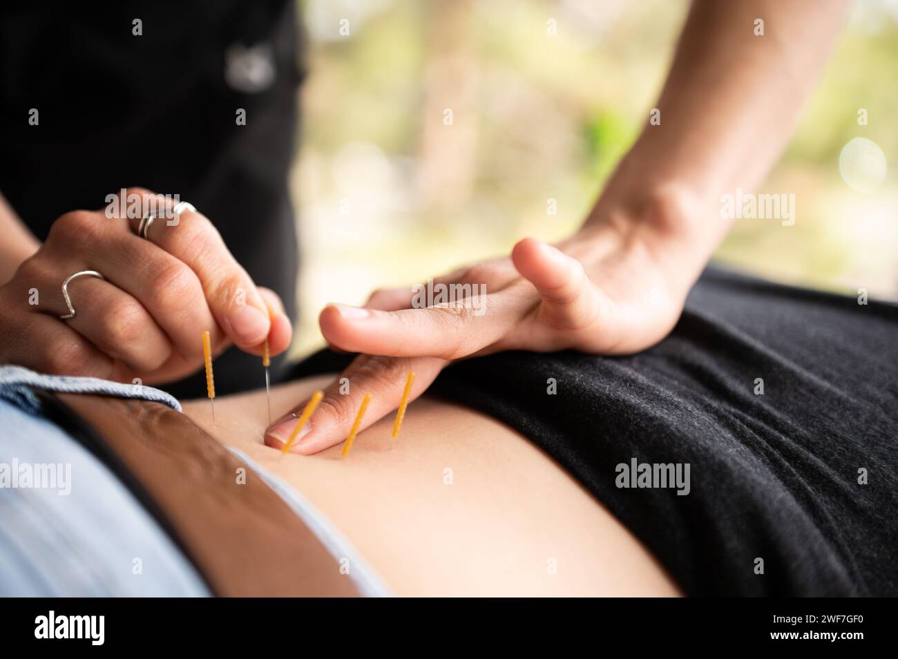 Thérapie à l'aiguille sèche : gros plan des mains, bien-être du dos. Banque D'Images