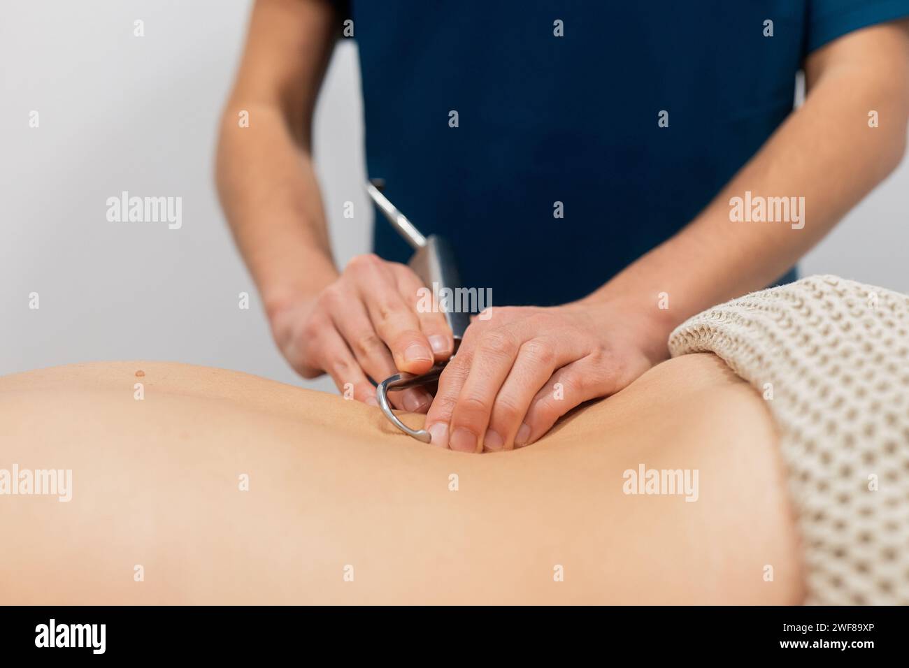 Vue rapprochée des mains d'un physiothérapeute appliquant un traitement d'aiguilletage sec sur le dos d'un patient pour soulager la douleur musculaire Banque D'Images