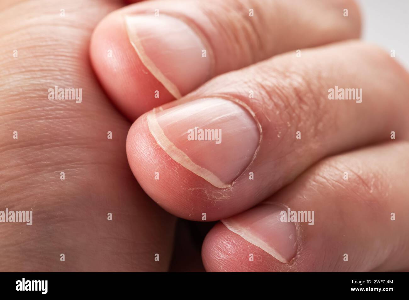 Lignes verticales dans les ongles Banque de photographies et d’images à — free download