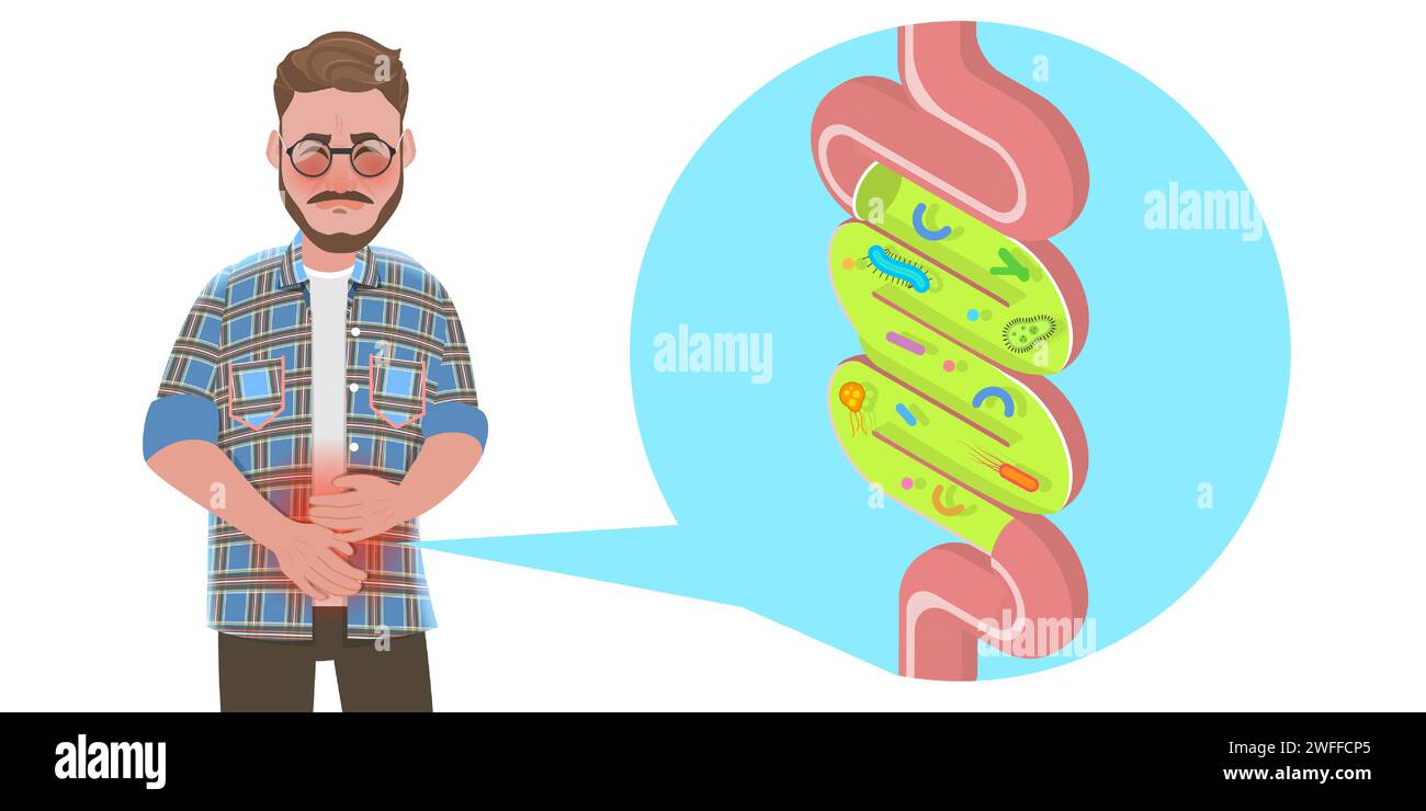 Illustration conceptuelle de vecteur plat isométrique 3D de l'inflammation de Gut, système digestif faible. Illustration de Vecteur