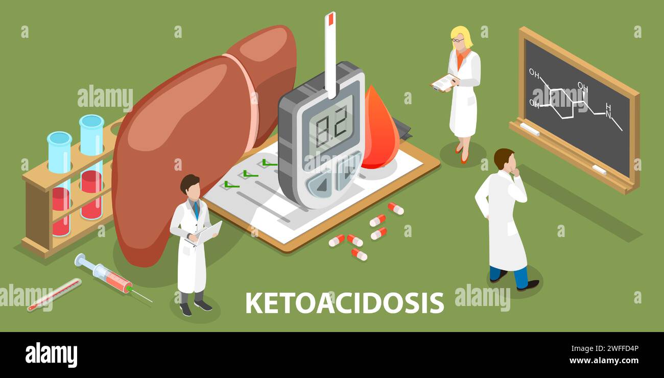 Illustration conceptuelle isométrique à vecteur plat 3D de l'acidocétose, production incontrôlée de corps cétoniques. Illustration de Vecteur