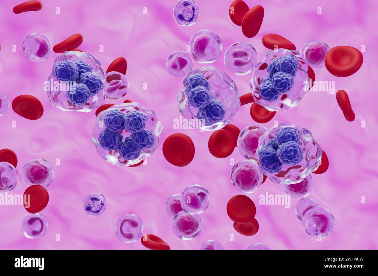 Cellules de lymphome T dans le flux sanguin - vue isométrique illustration 3D. Banque D'Images