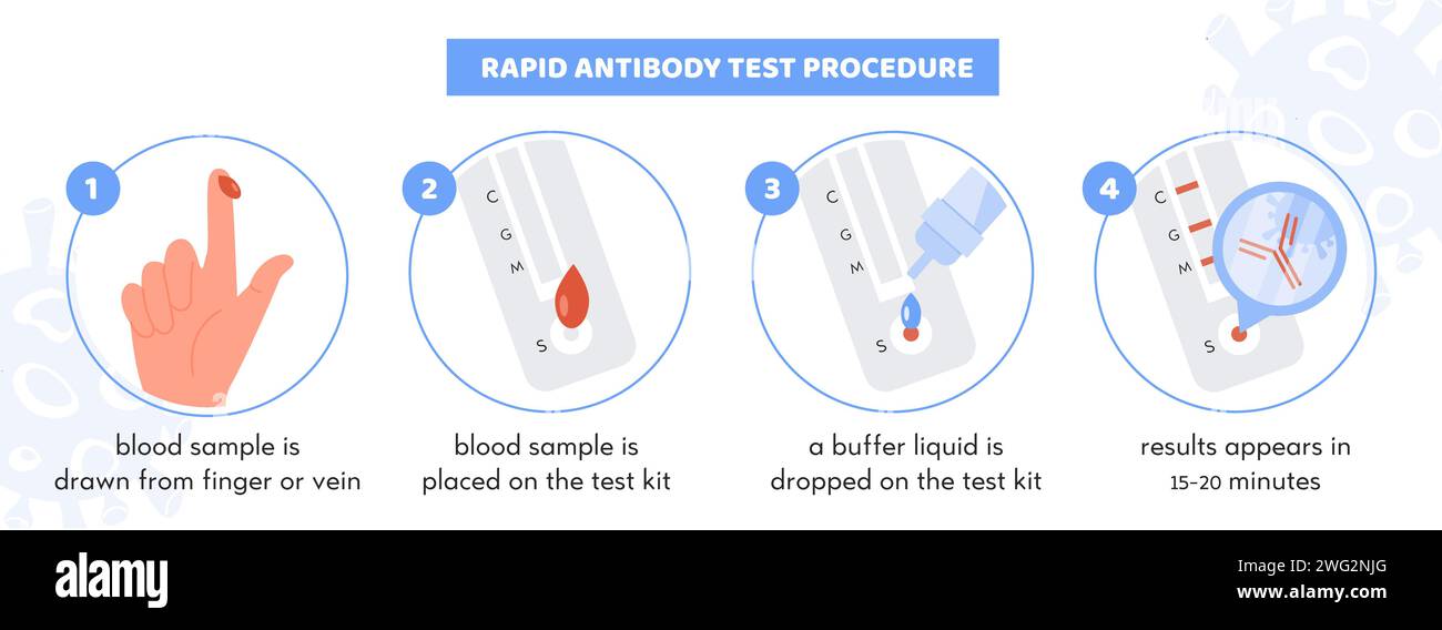 Infographie de la procédure de test rapide des anticorps Covid-19. Kit de test avec échantillon de sang patient. Tampon liquide sur bandelette de test. Résultat pour coronavirus avec un Illustration de Vecteur