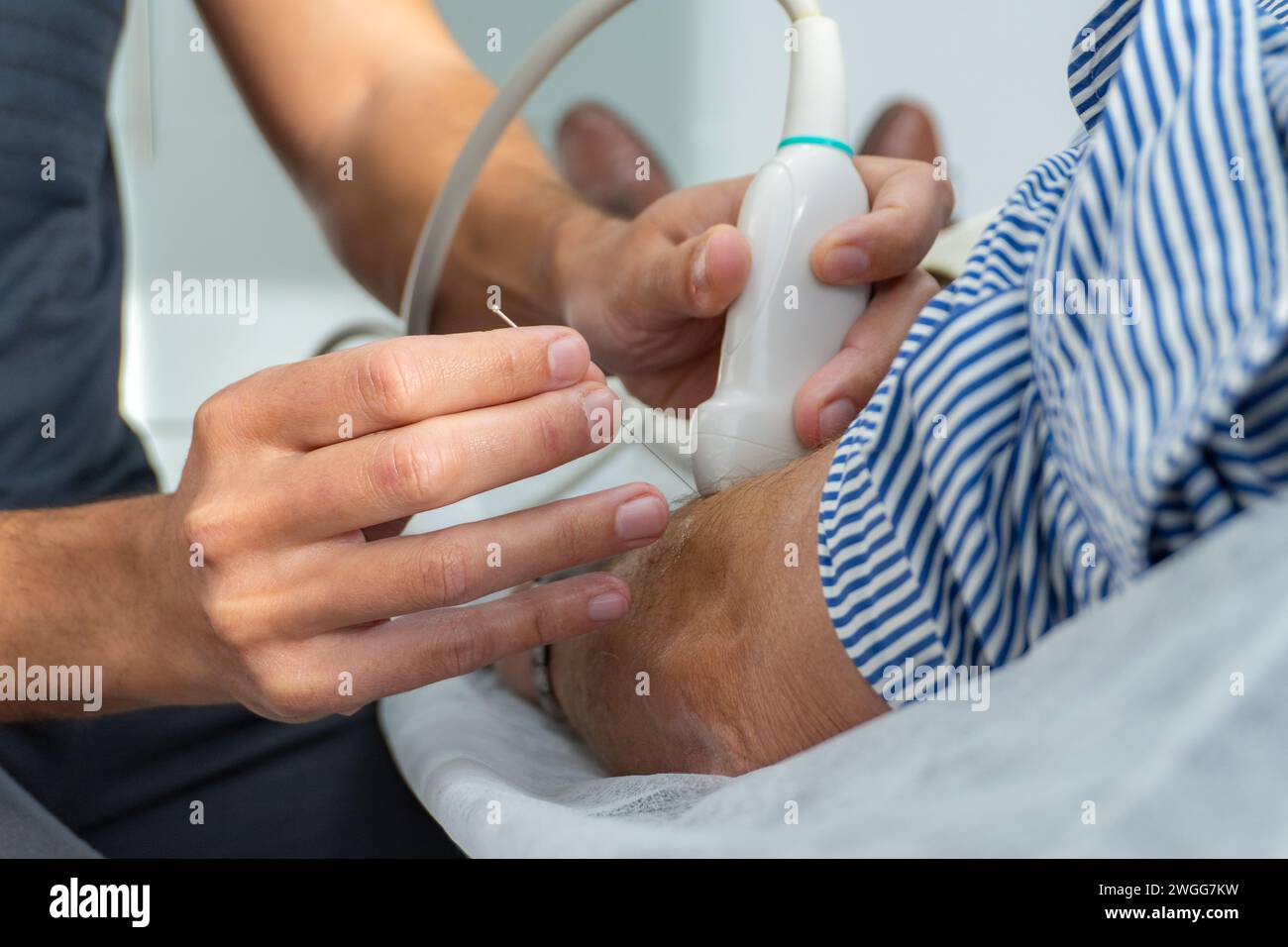 gros plan d'une main effectuant un aiguilletage sec avec aiguille et ultrasons Banque D'Images