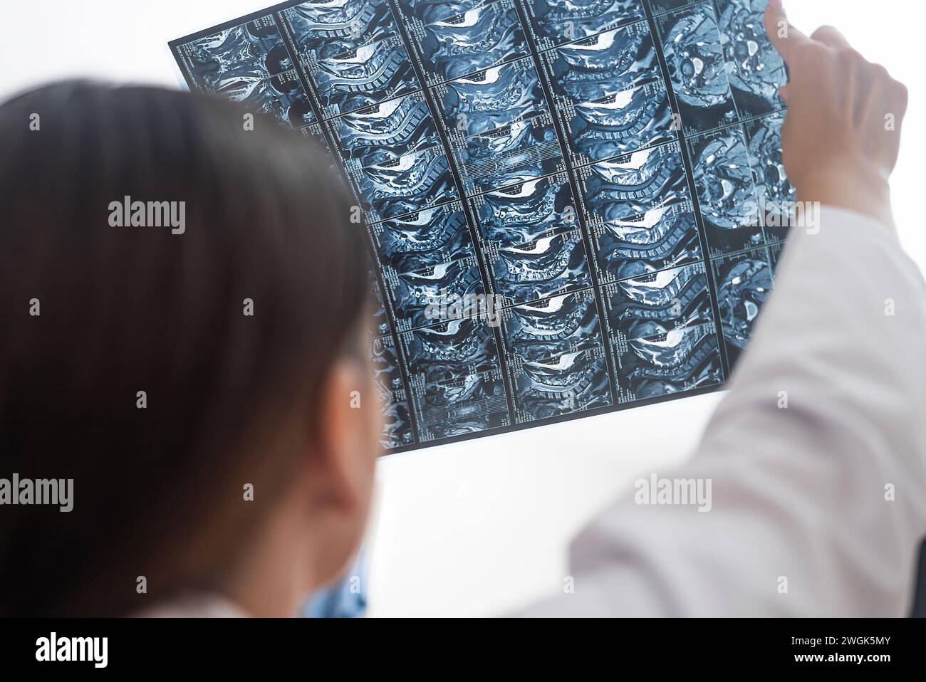Gros plan le médecin analyse les radiographies des patients par tomographie irm en tenant dans les mains Banque D'Images