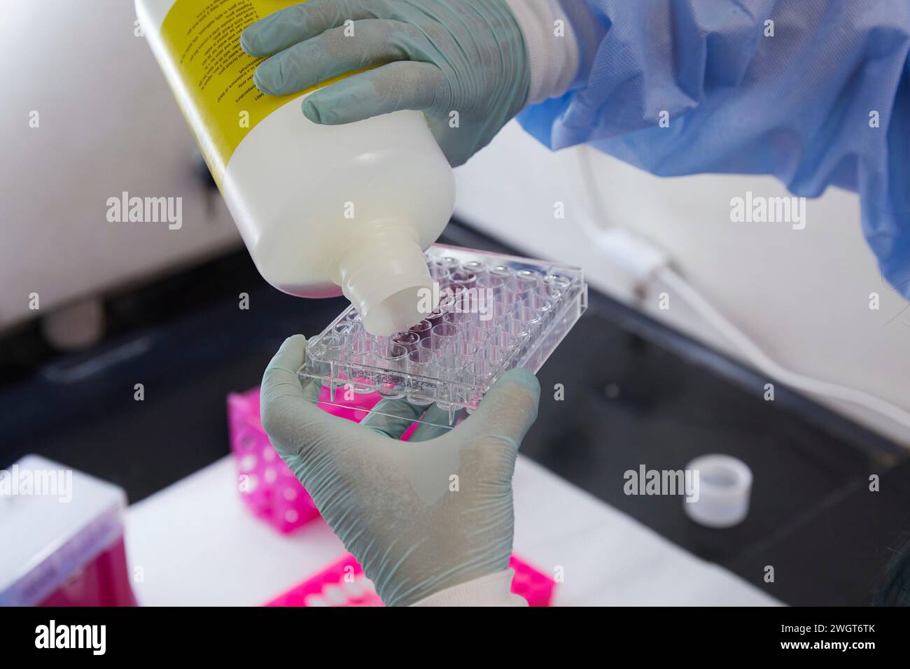 Outils et contenants dans un laboratoire médical, travail effectué avec pipette et échantillons Banque D'Images
