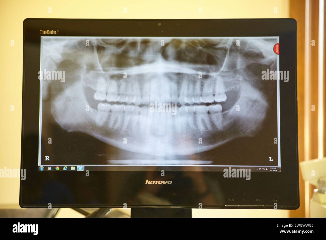 Radiographie dentaire panoramique sur le moniteur en clinique Banque D'Images