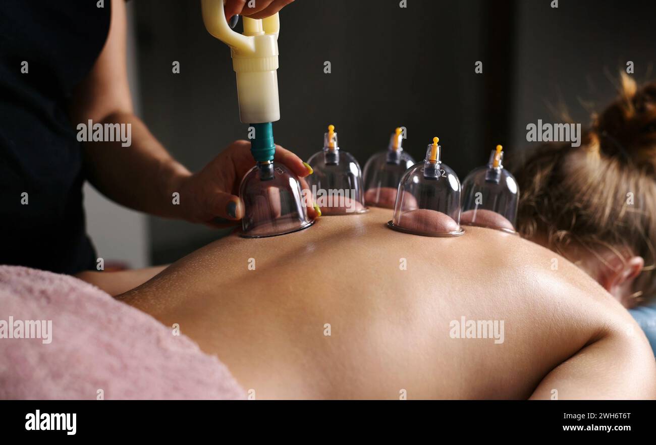 Procédures avec les gobelets sous vide dans Un salon de massage Spa Banque D'Images