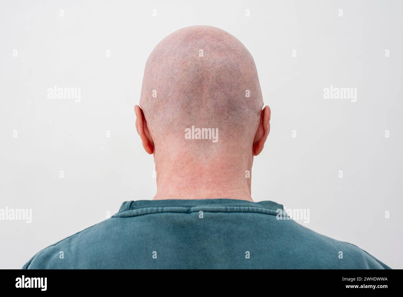 vue arrière d'un homme à la tête rasée. chauve Banque D'Images