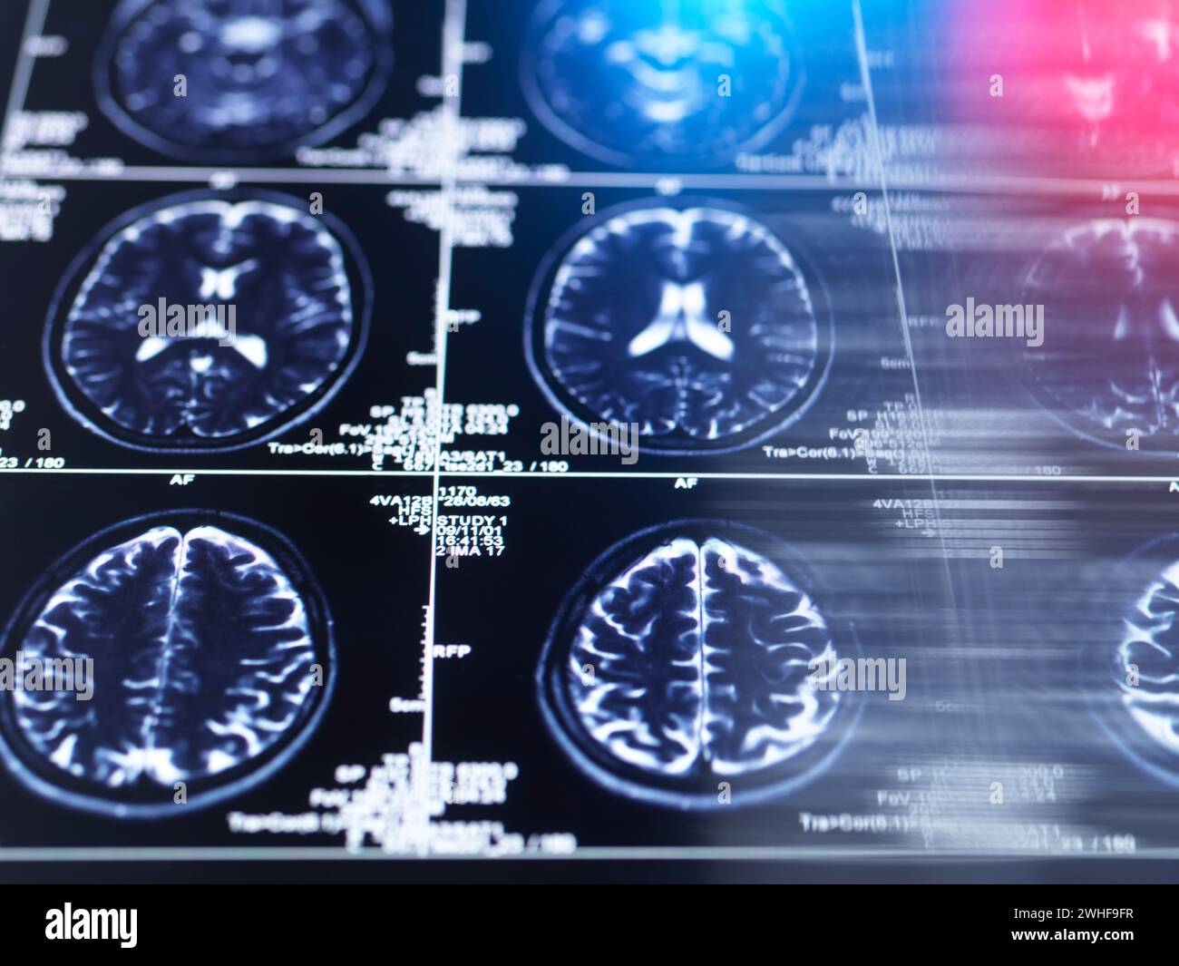 Recherche sur le cerveau, image conceptuelle Banque D'Images