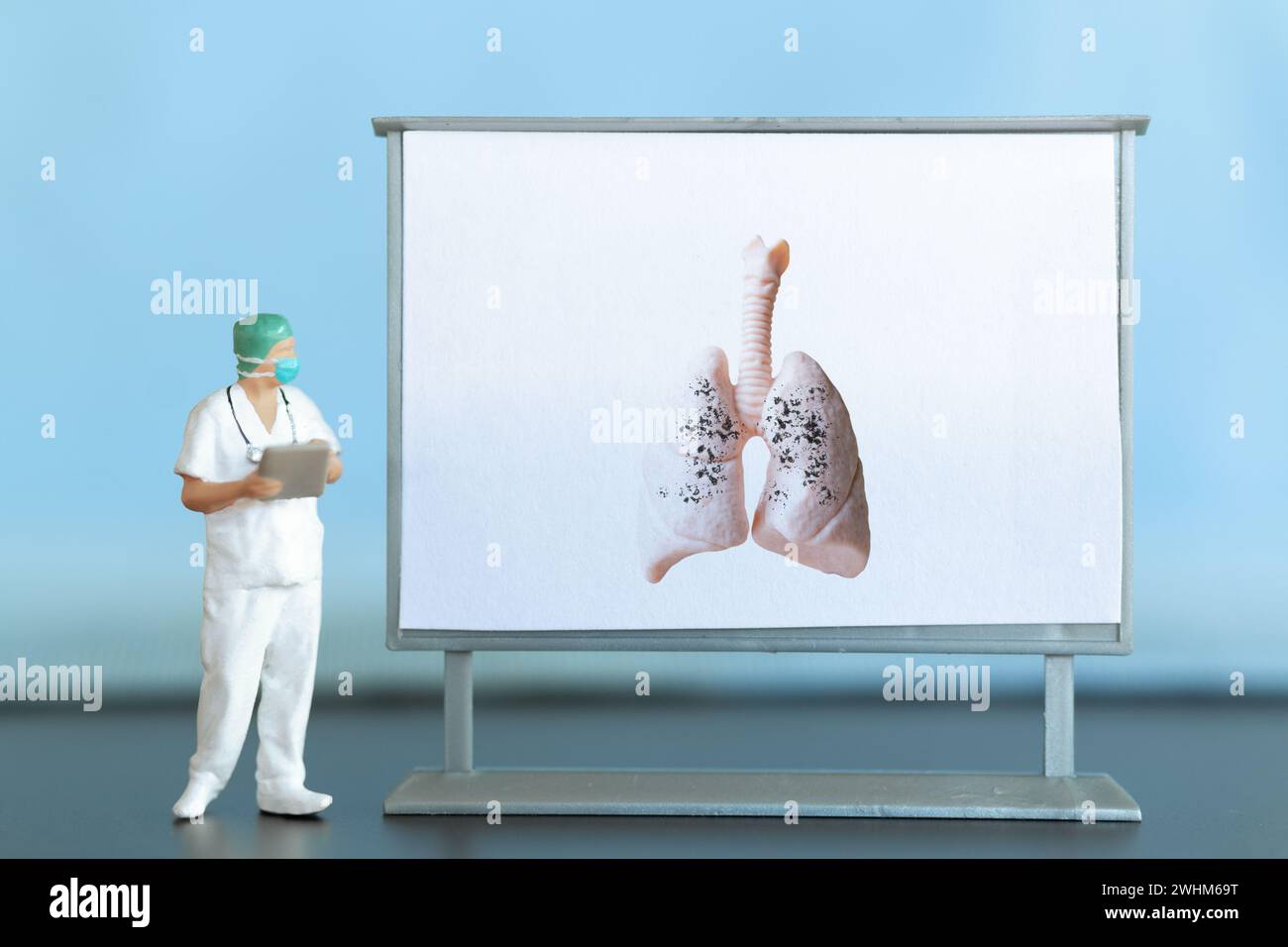 Personnages miniatures. Un médecin examine la pneumonie dans l'image, une maladie respiratoire. Banque D'Images