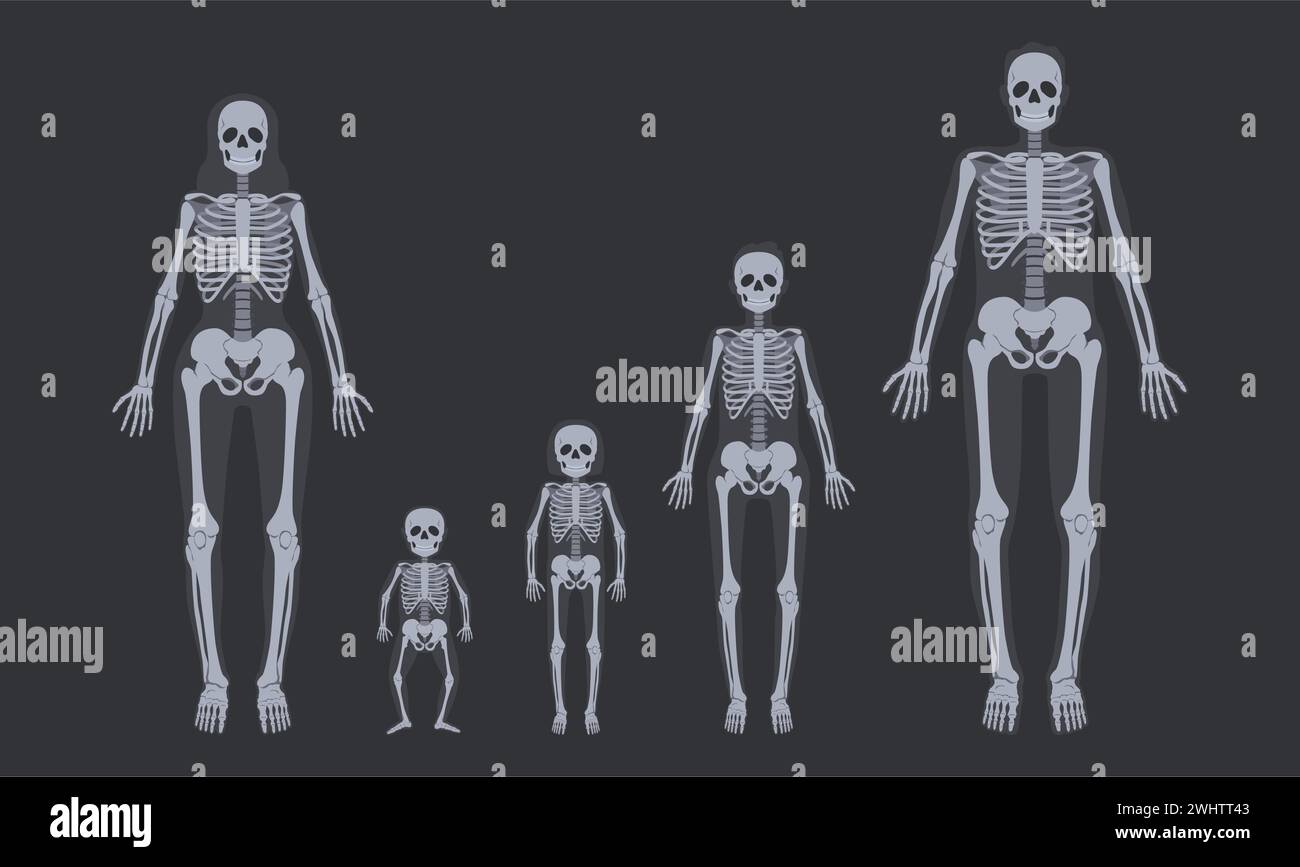 Squelettes de radiographie familiale. Les systèmes squelettiques humains de l'enfant à l'adulte. Ensemble d'illustrations vectorielles d'anatomie corporelle Illustration de Vecteur