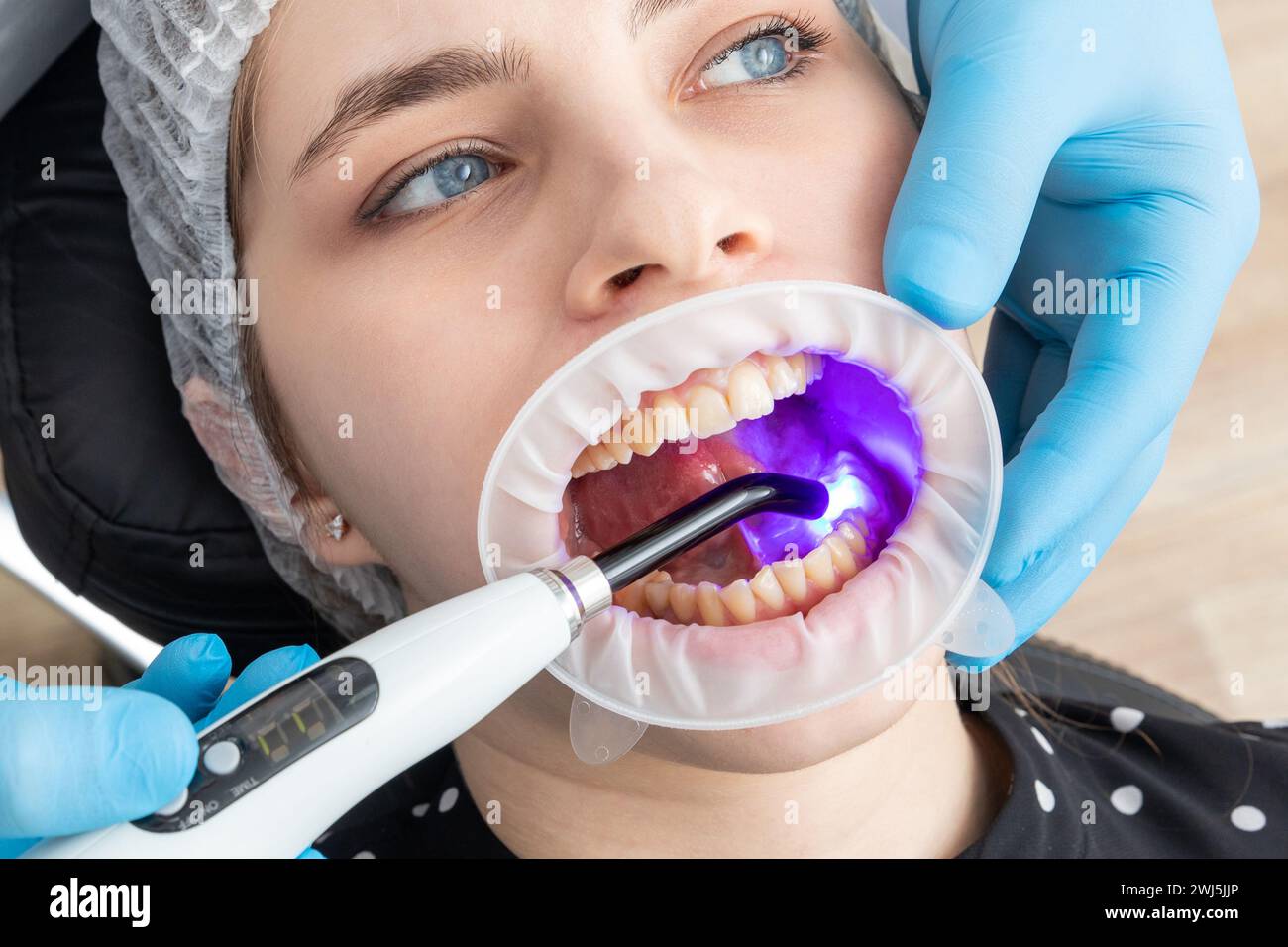 Vue en gros plan d'un dentiste utilisant une lampe UV à durcissement dentaire sur les dents du patient Banque D'Images