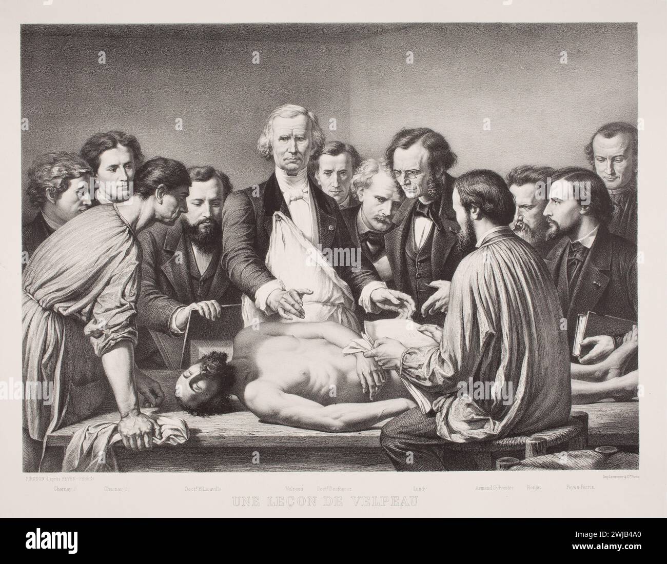 Lecon d'anatomie du docteur Velpeau. Imprimé Feyen-Perrin, François-Nicolas-Augustinm 1864. Leçon d'anatomie du Dr Velpeau à un groupe de médecins sur un patient, éventuellement cadavre. Banque D'Images