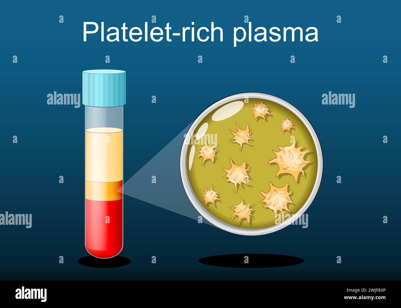 Processus med Banque d'images vectorielles - Alamy