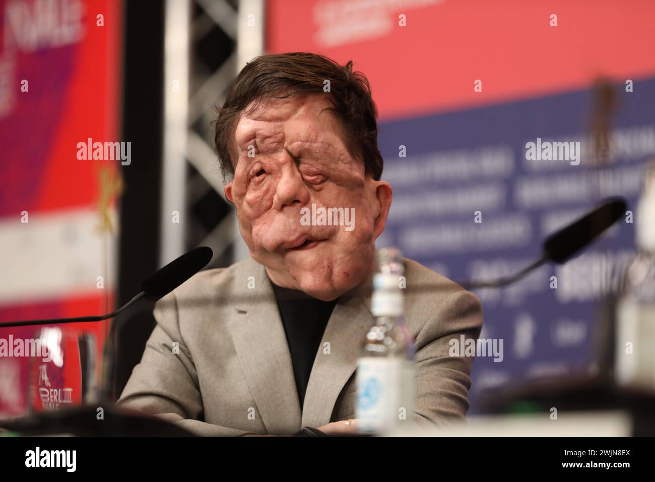 Berlin, Deutschland, 16.02.2024. Hôtel Grand Hyatt : 74. Berlinale : Pressekonferenz mit dem Team Regisseur, Schauspieler von film Un homme différent : Adam Pearson *** Berlin, Allemagne, 16 02 2024 Hotel Grand Hyatt 74 Berlinale Conférence de presse avec l'équipe réalisateur, acteur du film Un homme différent Adam Pearson Copyright : xdtsxNachrichtenagenturx dts 30789 Banque D'Images