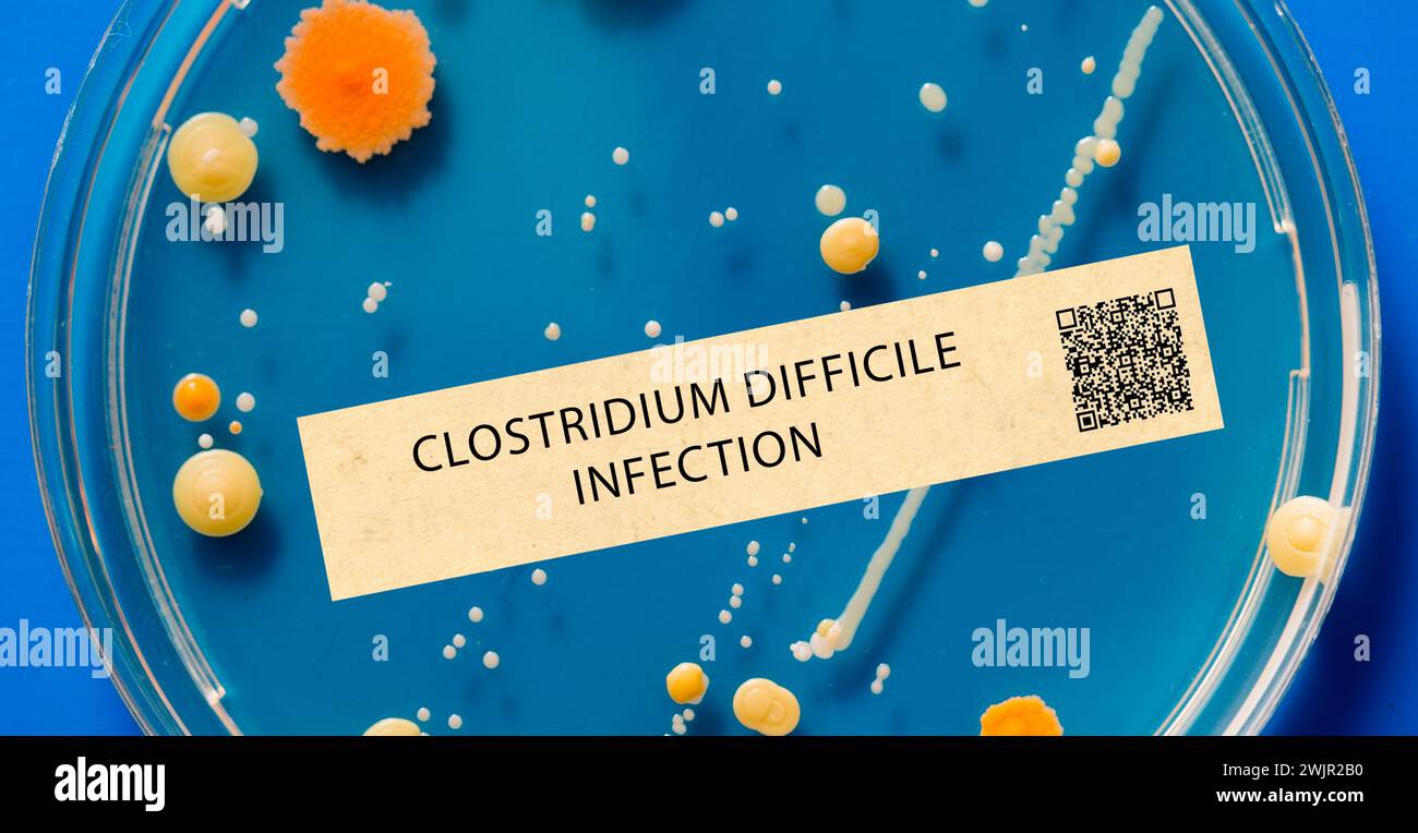 Infection à Clostridium difficile Banque D'Images