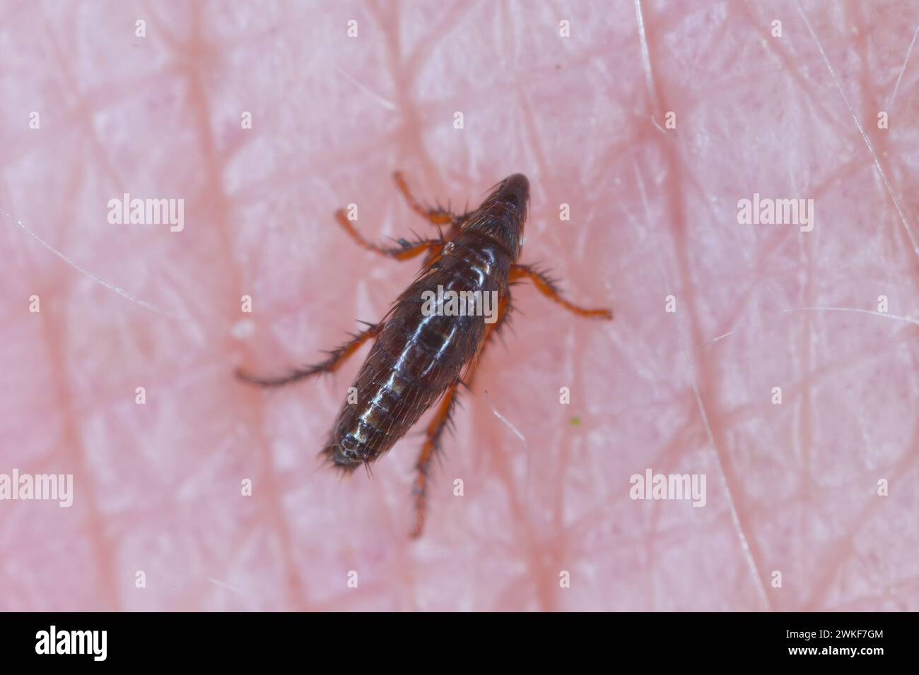 Puce de chien (Ctenophalides canis) piquant et buvant du sang sur la peau humaine. Banque D'Images