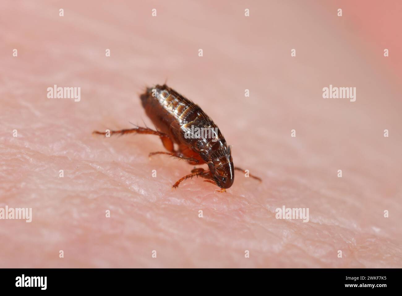 Puce. Insectes piquant et buvant du sang sur la peau humaine. Banque D'Images