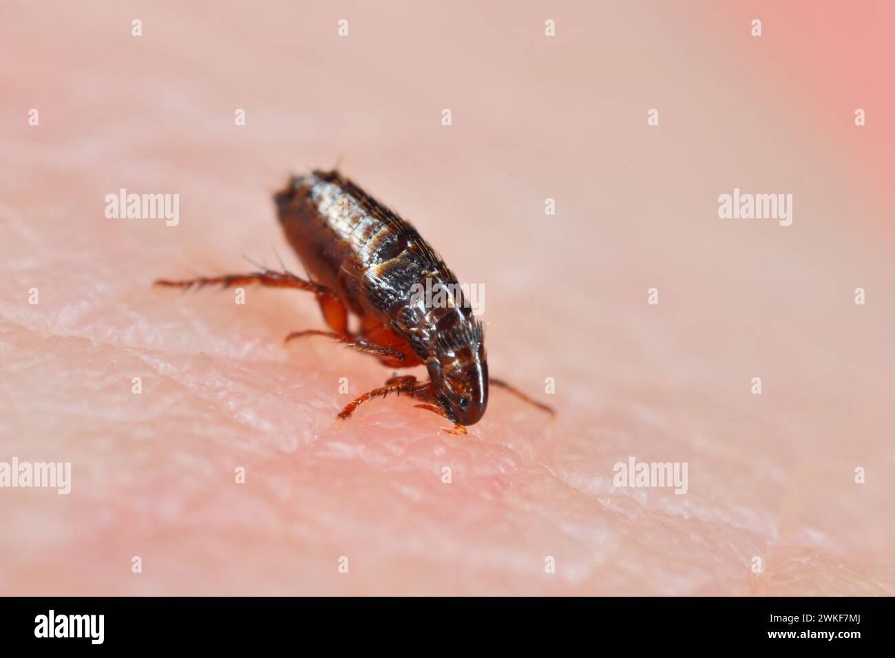Puce. Insectes piquant et buvant du sang sur la peau humaine. Banque D'Images