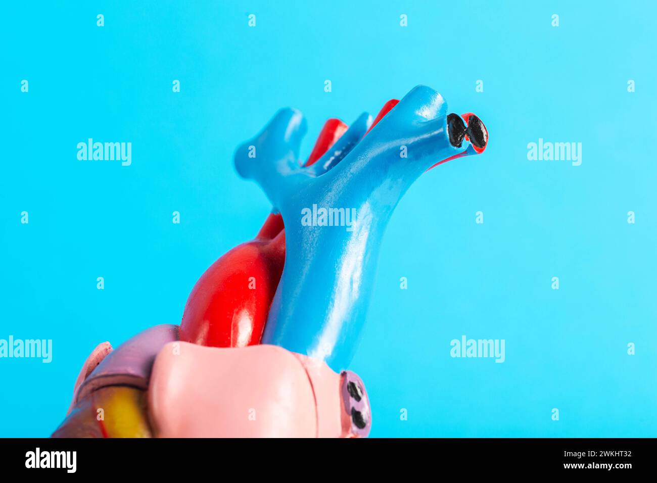 Modèle médical des vaisseaux cardiaques sur fond bleu, gros plan. Athérosclérose des artères coronaires, coronarographie Banque D'Images