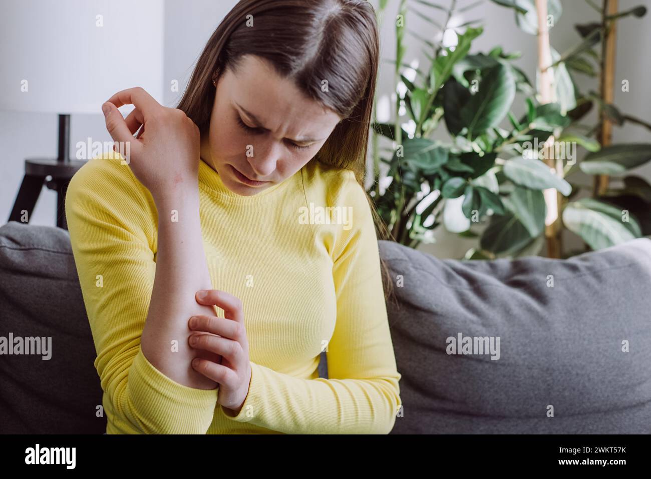 Triste jeune femme caucasienne avec une réaction allergique atopique, piqûres d'insectes sur son bras, main en grattant des démangeaisons, une tache rouge démangeaison ou une éruption cutanée. La santé Banque D'Images