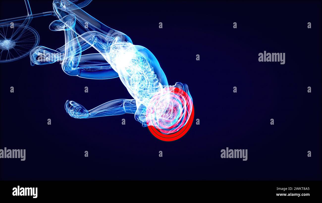 Illustration abstraite d'un cycliste et d'une commotion cérébrale Banque D'Images