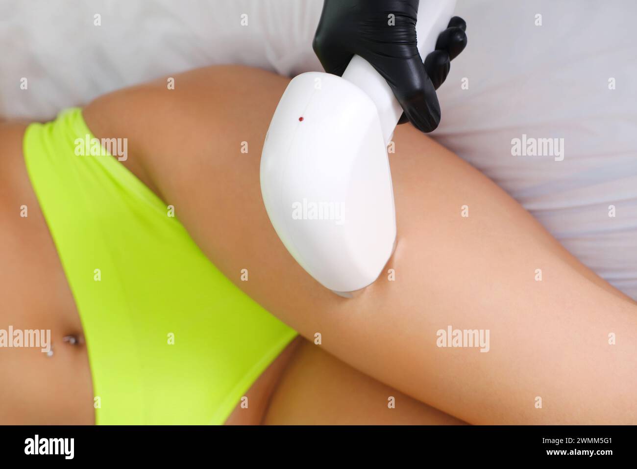 Le moment exact de la procédure d'épilation au laser sur les jambes. Gros plan horizontal Banque D'Images