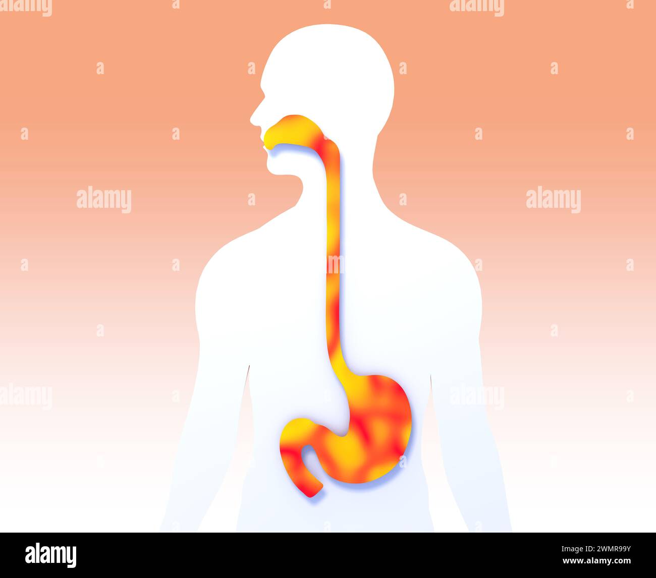 illustration 3d de l'estomac et de l'œsophage à la bouche avec le feu. Montrer le système digestif anatomique sur la silhouette humaine découpée. Banque D'Images