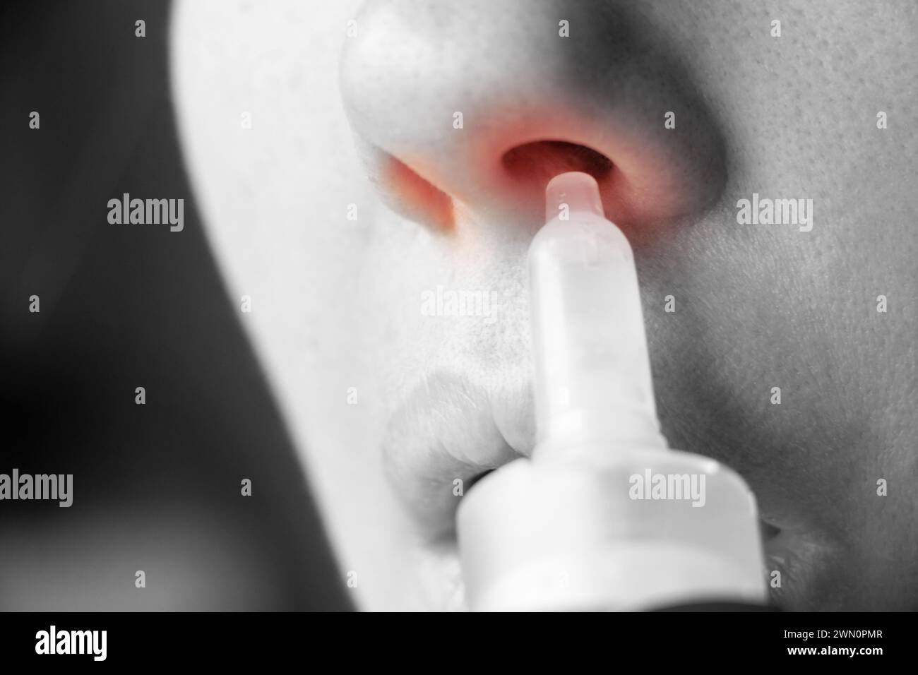 Fille et gouttes de nez gros plan, froid et traitement du nez qui coule, nez qui coule Banque D'Images