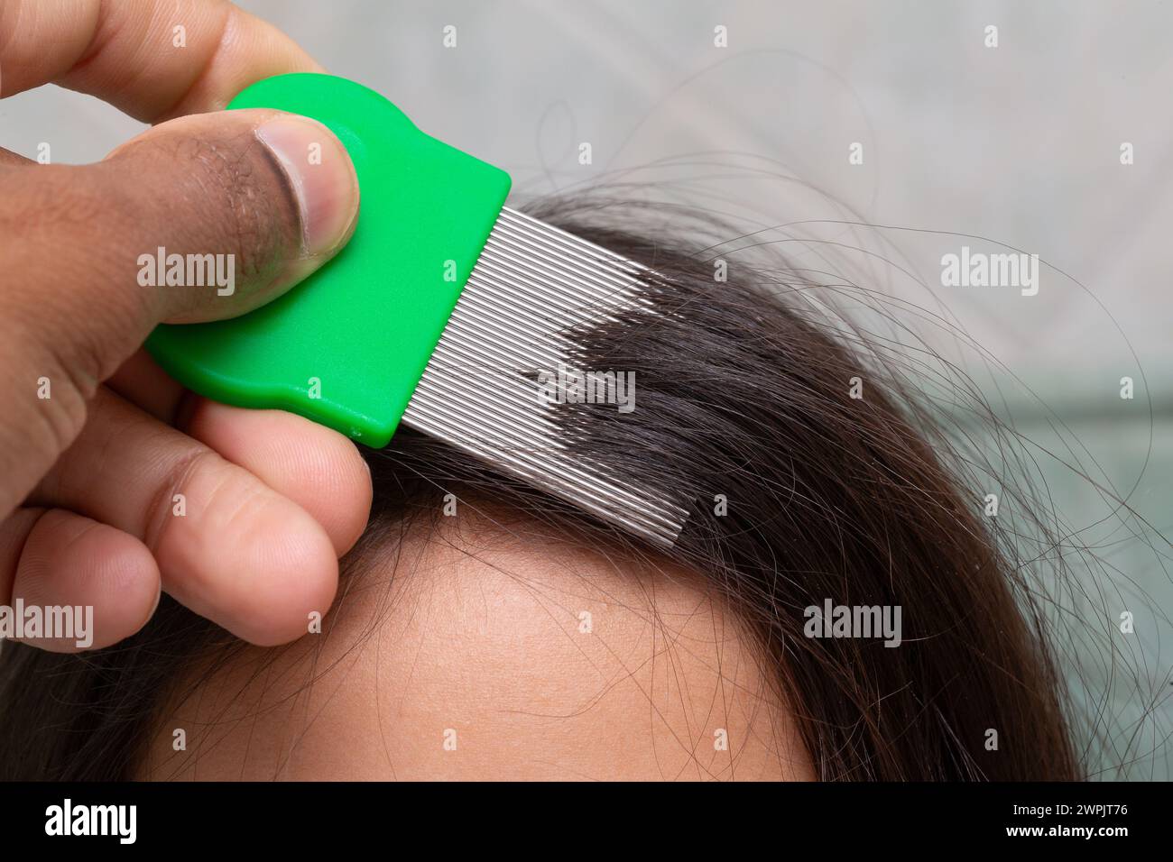 une image en gros plan d'une main peignant méticuleusement les cheveux avec un peigne vert à dents fines, ciblant l'élimination des lentes de poux. le processus exemplifi Banque D'Images